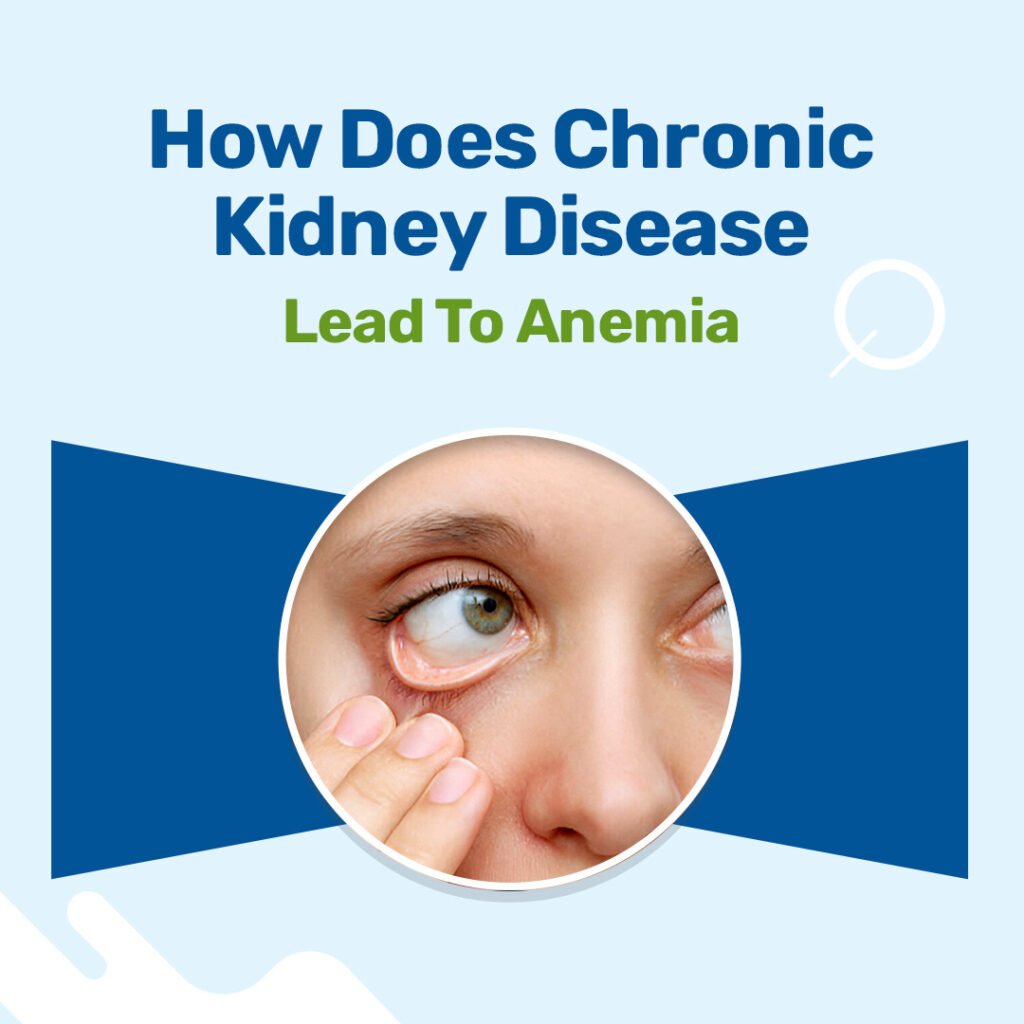 How Does Chronic Kidney Disease Lead To Anemia