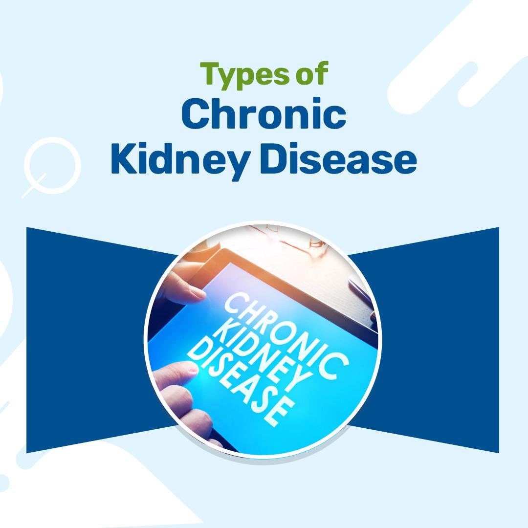 Types of CKD