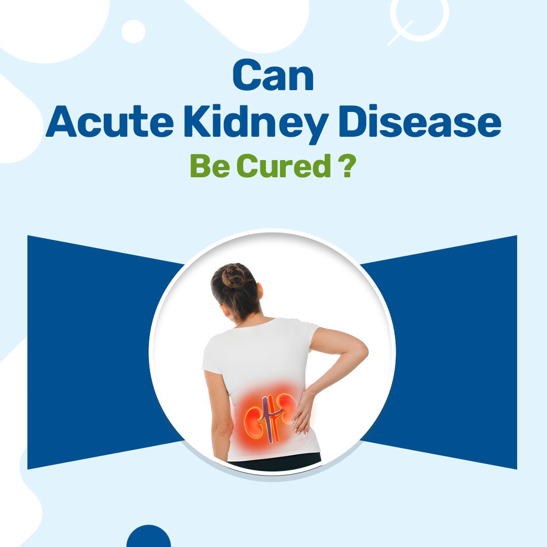 Can Acute Kidney Disease Be Cured