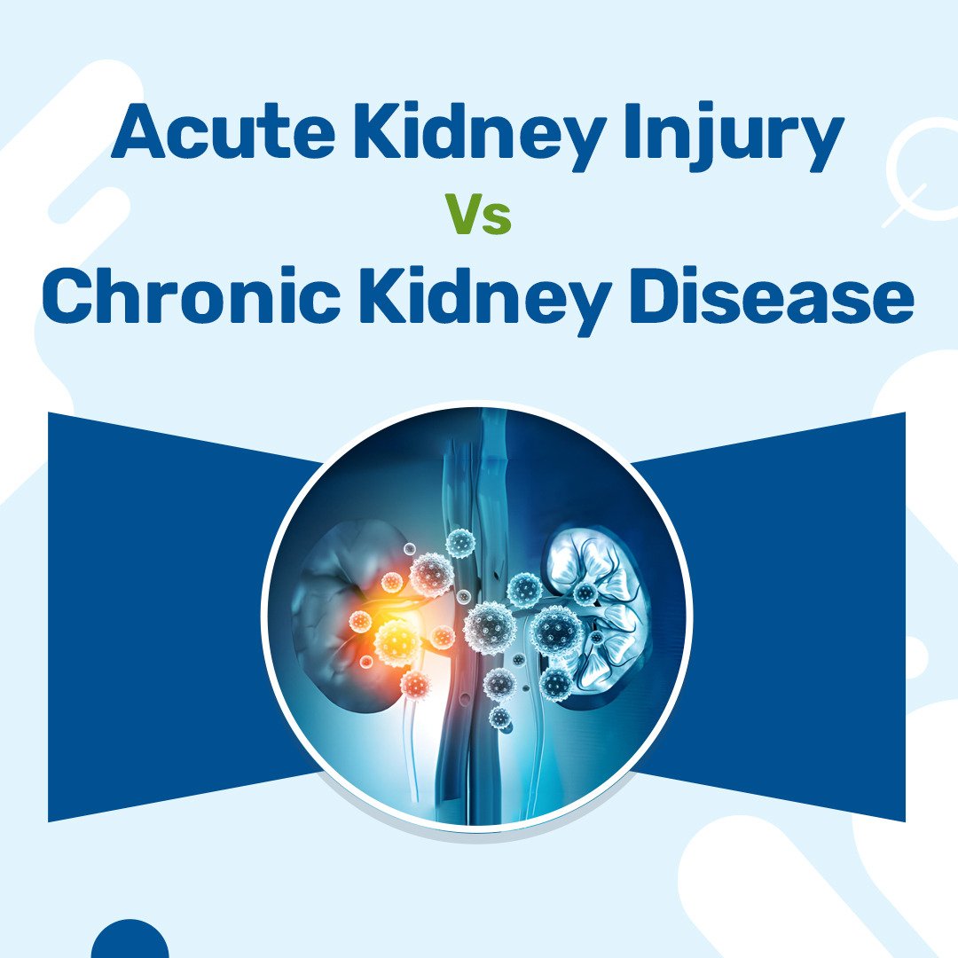 Acute Kidney Injury vs Chronic Kidney Disease
