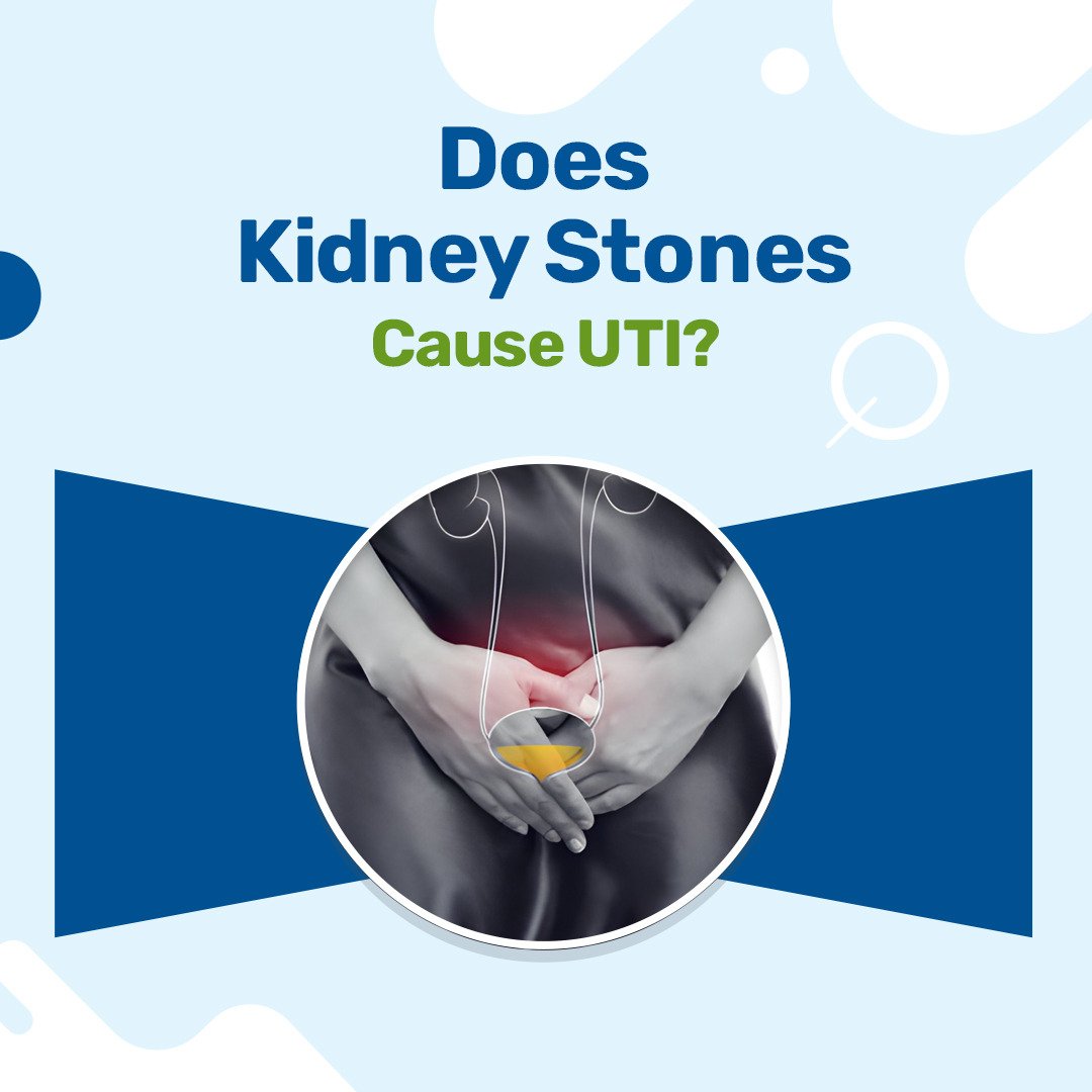 Does Kidney Stones Cause UTI