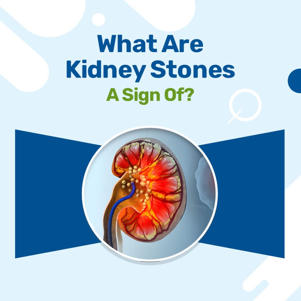 What Are Kidney Stones A Sign Of?
