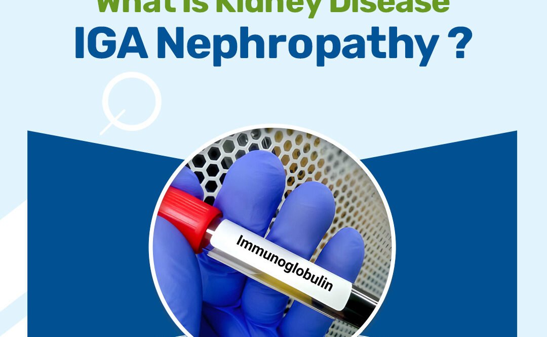 Kidney Disease IGA Nephropathy