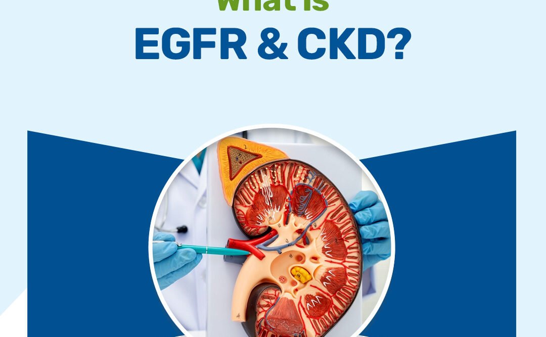 What Is EGFR And CKD