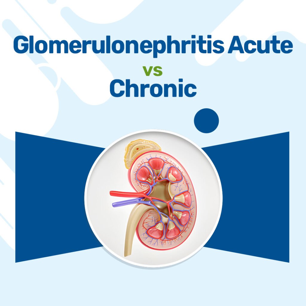 Glomerulonephritis Acute vs Chronic