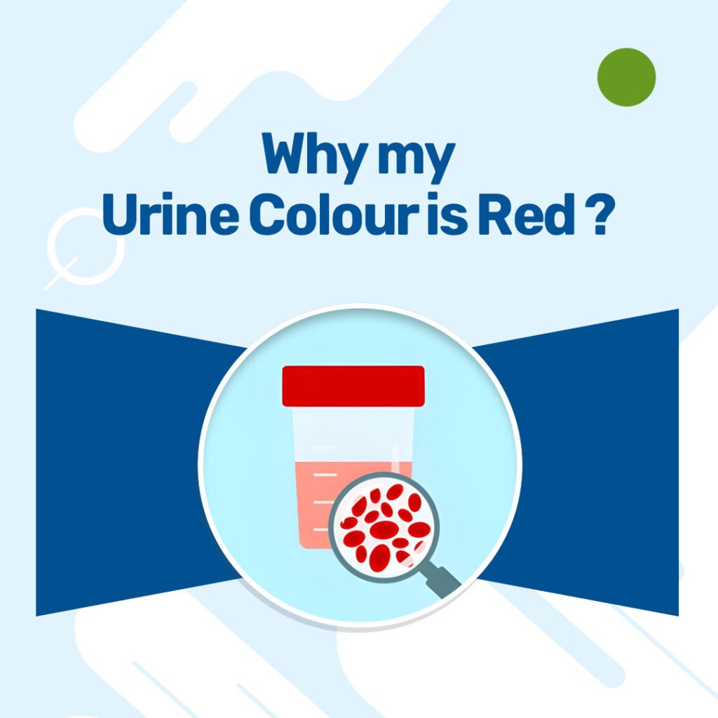 Why My Urine Colour Is Red