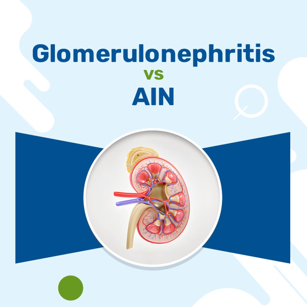 Glomerulonephritis vs AIN