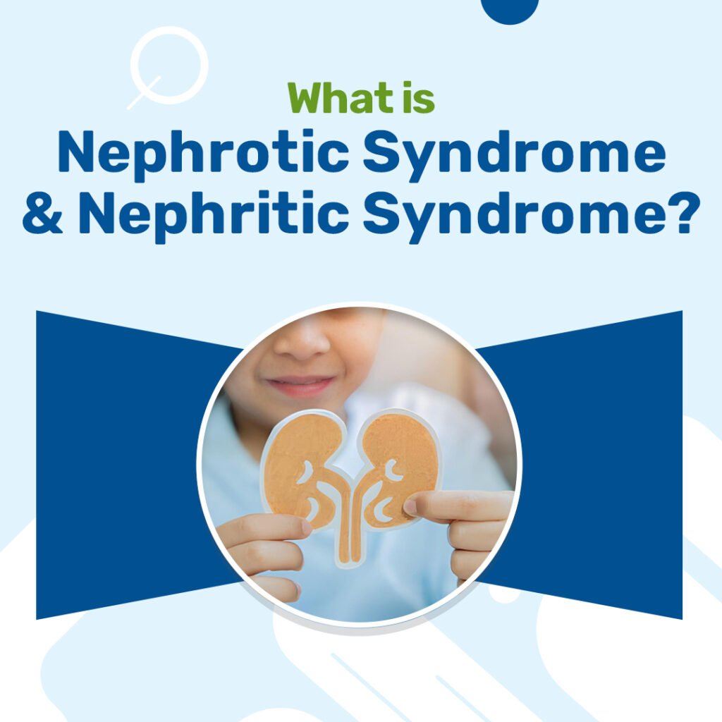 Nephrotic Syndrome and Nephritic Syndrome